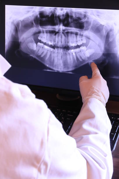 Best Emergency Treatment for Oral Infections in Davenport, FL
