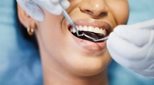 Best Emergency Root Canal Therapy in Davenport, FL